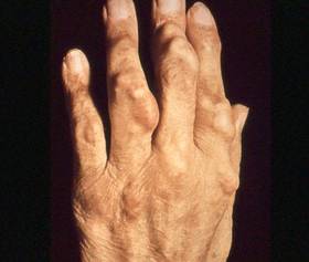 hand2.jpg